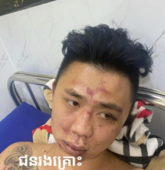 波贝一中国餐厅老板夫妇被殴打-柬之窗