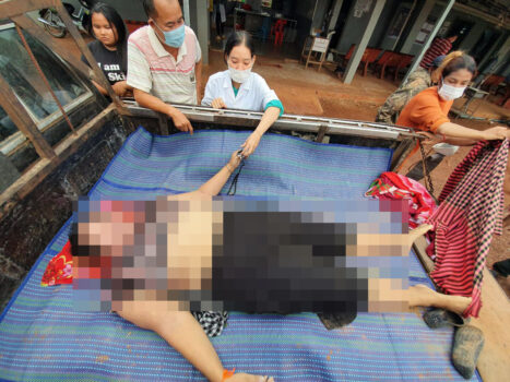 暹粒省发生雷击造成1人死亡，2人受伤-柬之窗